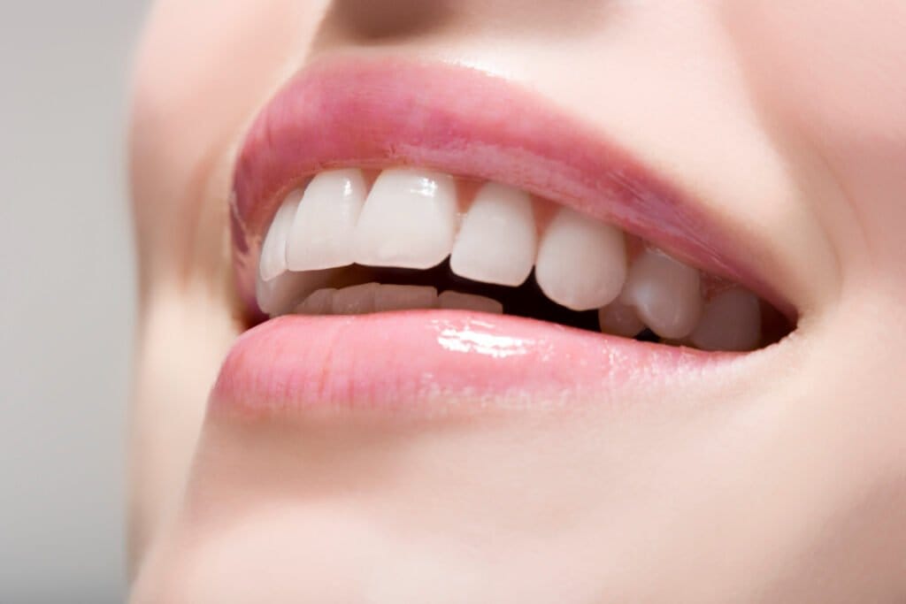 Close up of woman smiling with full upper lip after a Botox lip flip