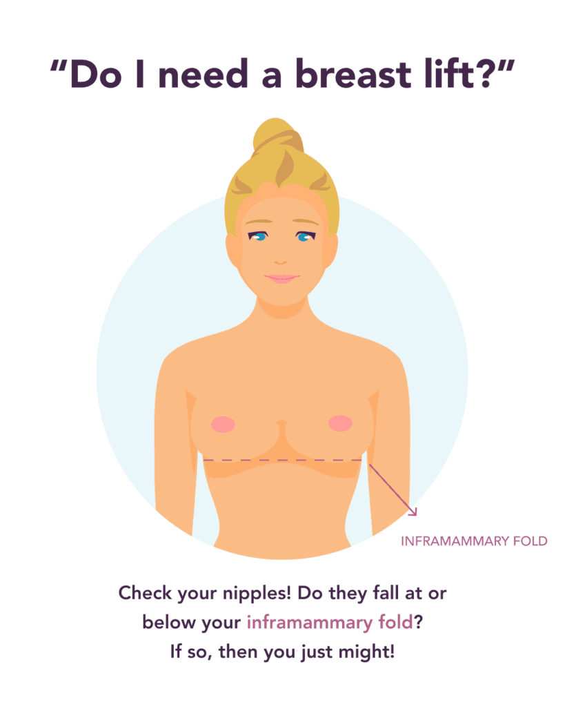 Breast lift self assessment guide