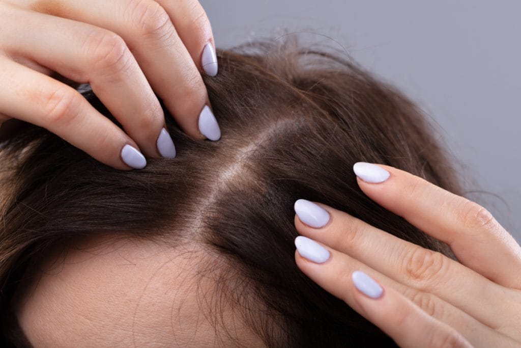 Woman touching scalp to see new recent hair growth after taking Low-Dose Oral Minoxidil (LDOM) tablets